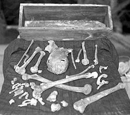 Magnus’ relikvier, fotografert kort etter at de ble gjenfunnet. (Foto: Orkney Library Image Archives)